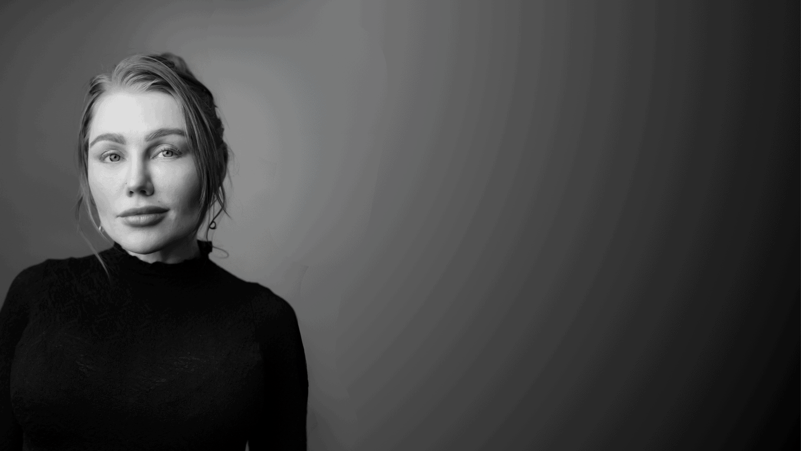 Rochelle-fibroblast-specialist